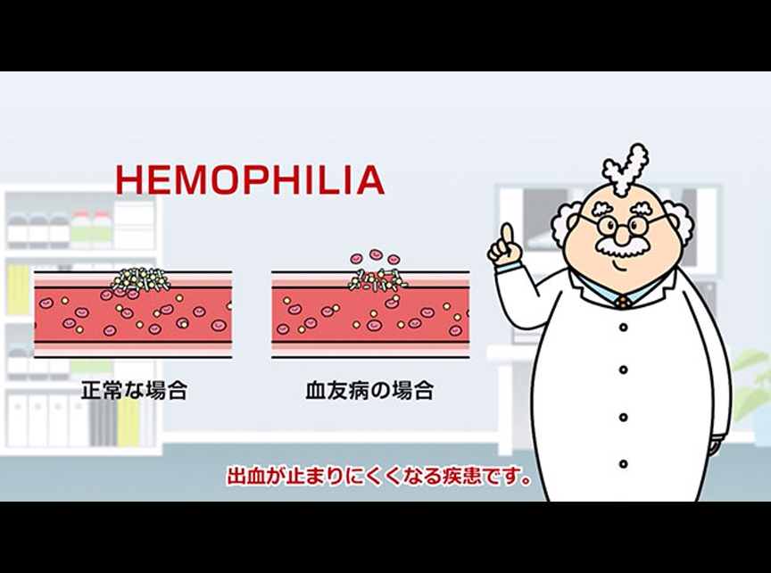 ヘモフィリアは出血が止まりにくくなる疾患です。