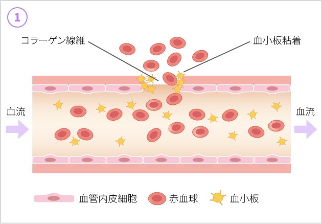 止血のしくみ - 傷ついた血管（Hemostasis）