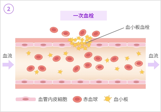 止血のしくみ - 一次止血（Hemostasis）