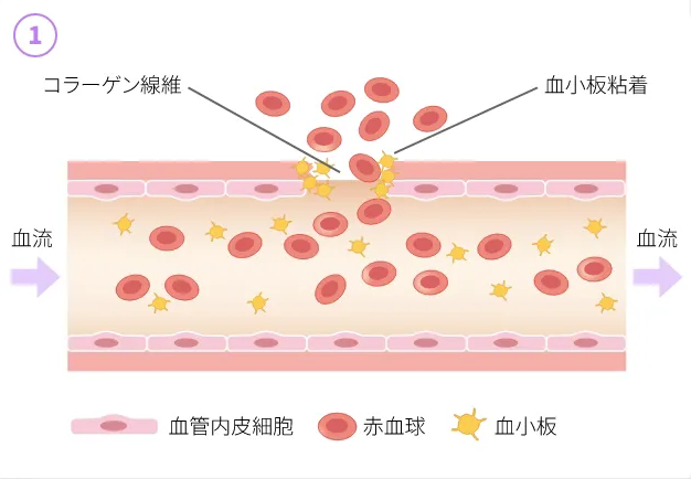 止血のしくみ - 傷ついた血管（Hemostasis）
